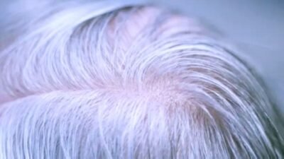 دراسة: الشيب قد يحمي من سرطان الجلد عبر آلية مناعية طبيعية